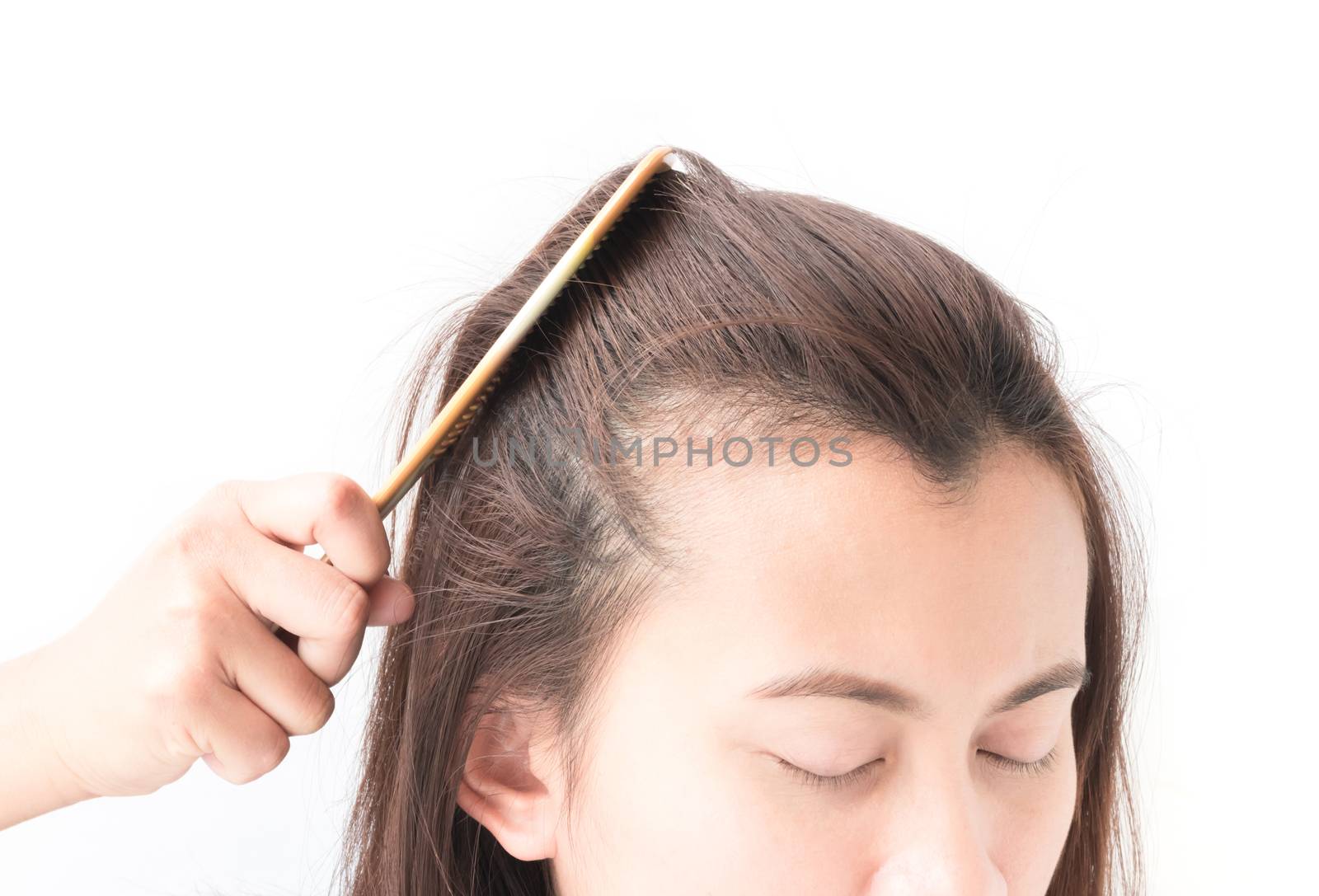 Woman serious hair loss problem for health care shampoo and beau by pt.pongsak@gmail.com