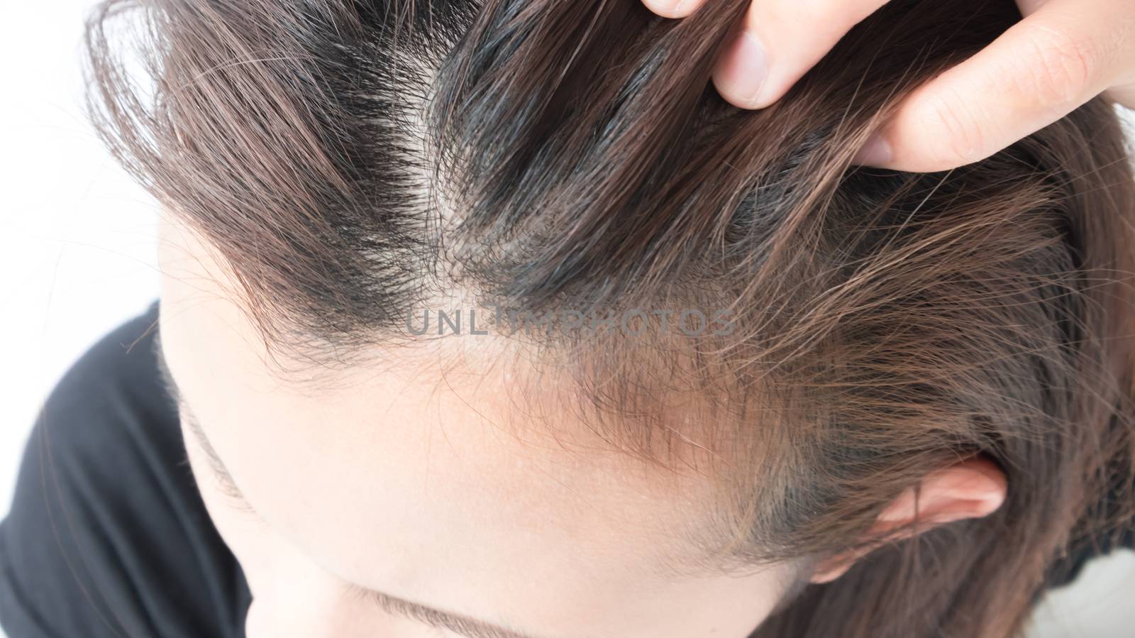 Closeup woman hand itchy scalp, Hair care concept by pt.pongsak@gmail.com