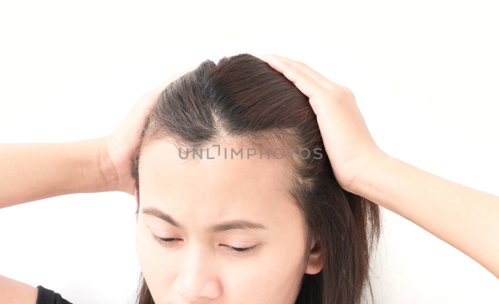 Woman serious hair loss problem for health care shampoo and beauty product concept