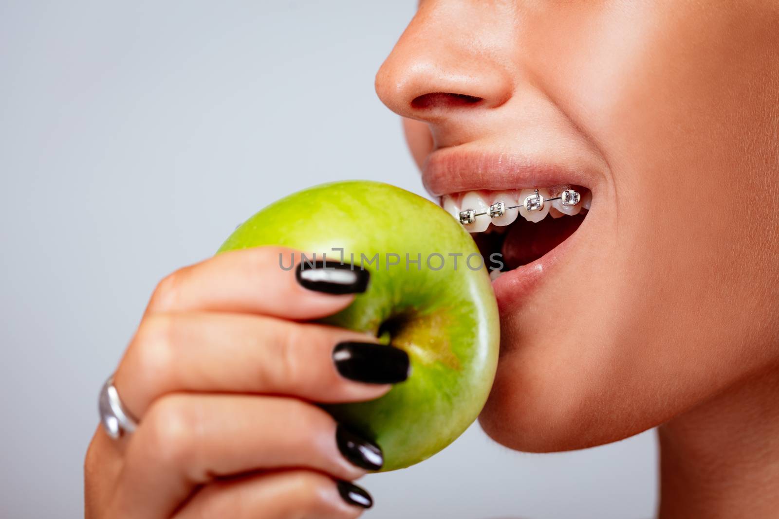 Close-up of a smiling girl face with braces on white teeth holding green apple.