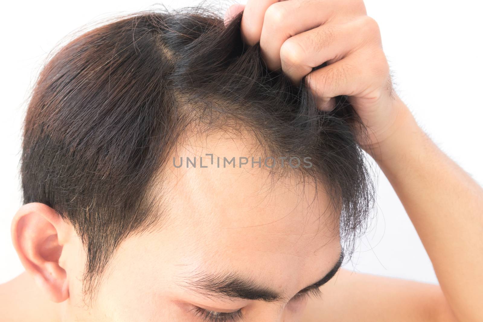 Young man worry hair loss problem for health care shampoo by pt.pongsak@gmail.com