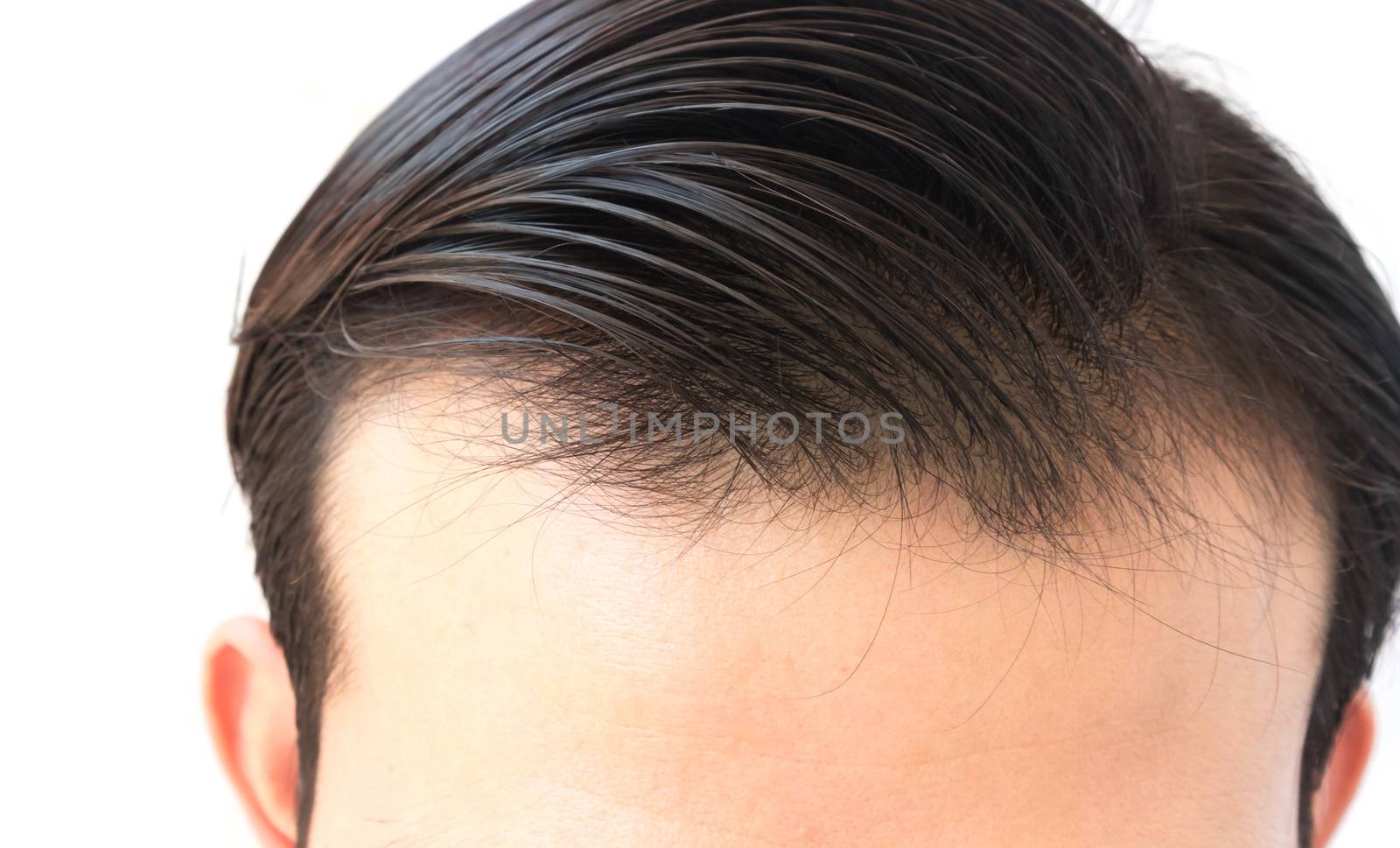 Young man worry hair loss problem for health care shampoo by pt.pongsak@gmail.com