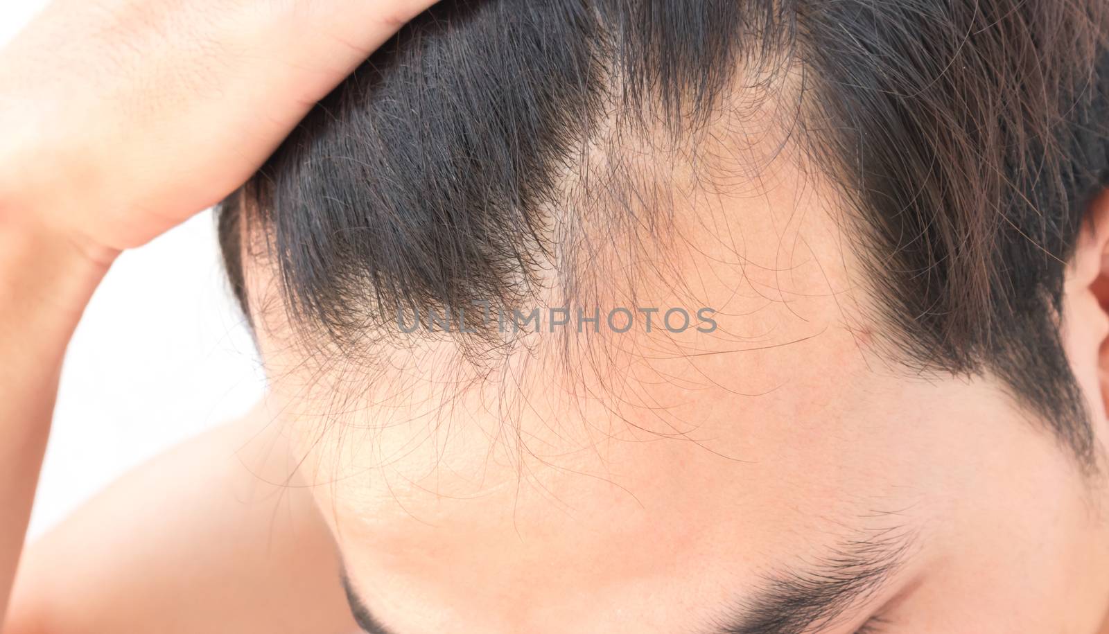 Young man worry hair loss problem for health care shampoo by pt.pongsak@gmail.com