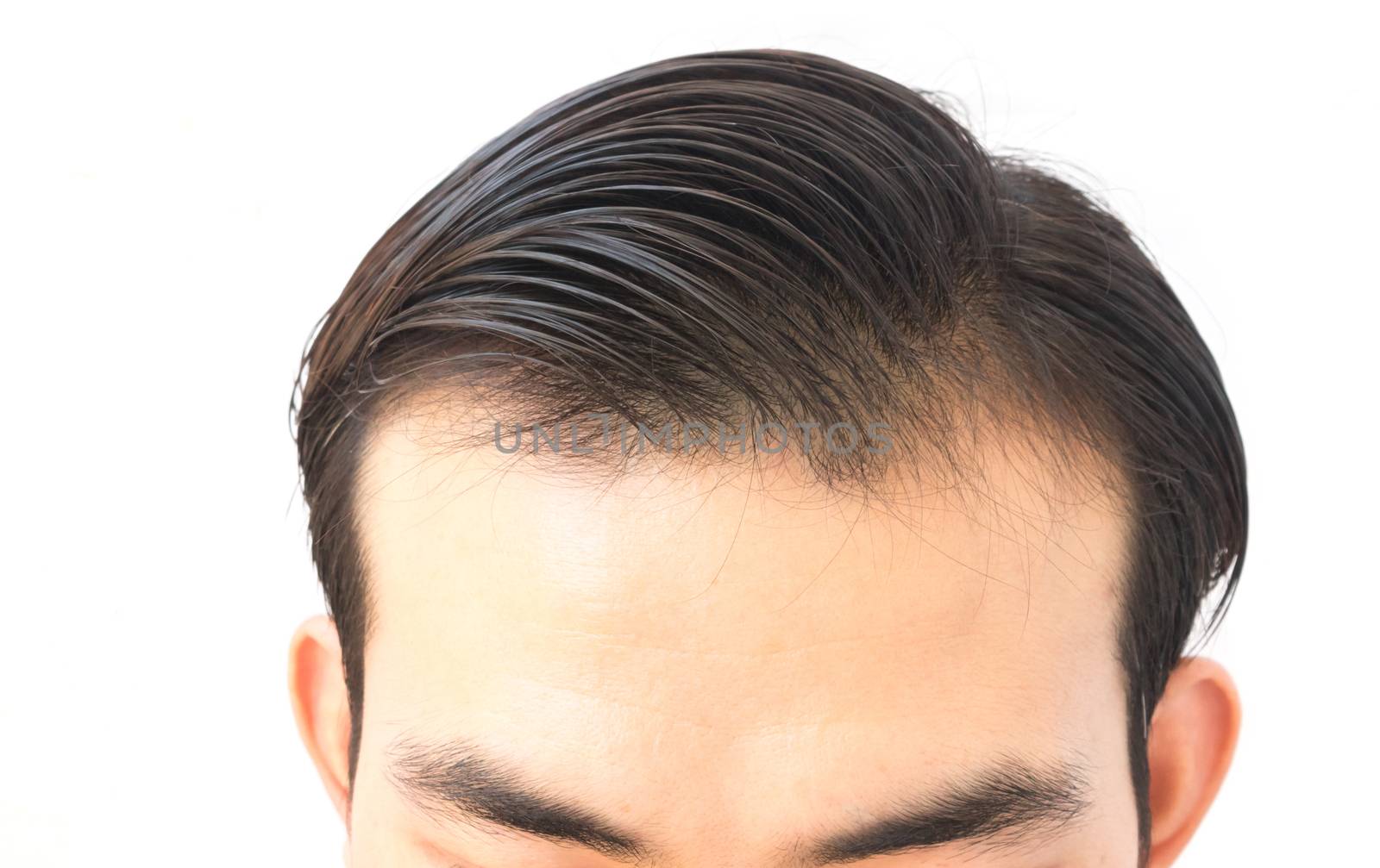 Young man worry hair loss problem for health care shampoo by pt.pongsak@gmail.com