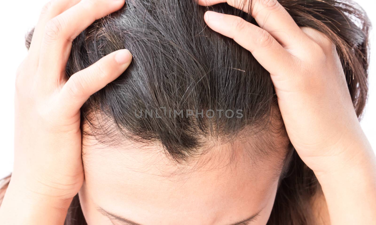 Closeup woman hand itchy scalp, Hair care concept