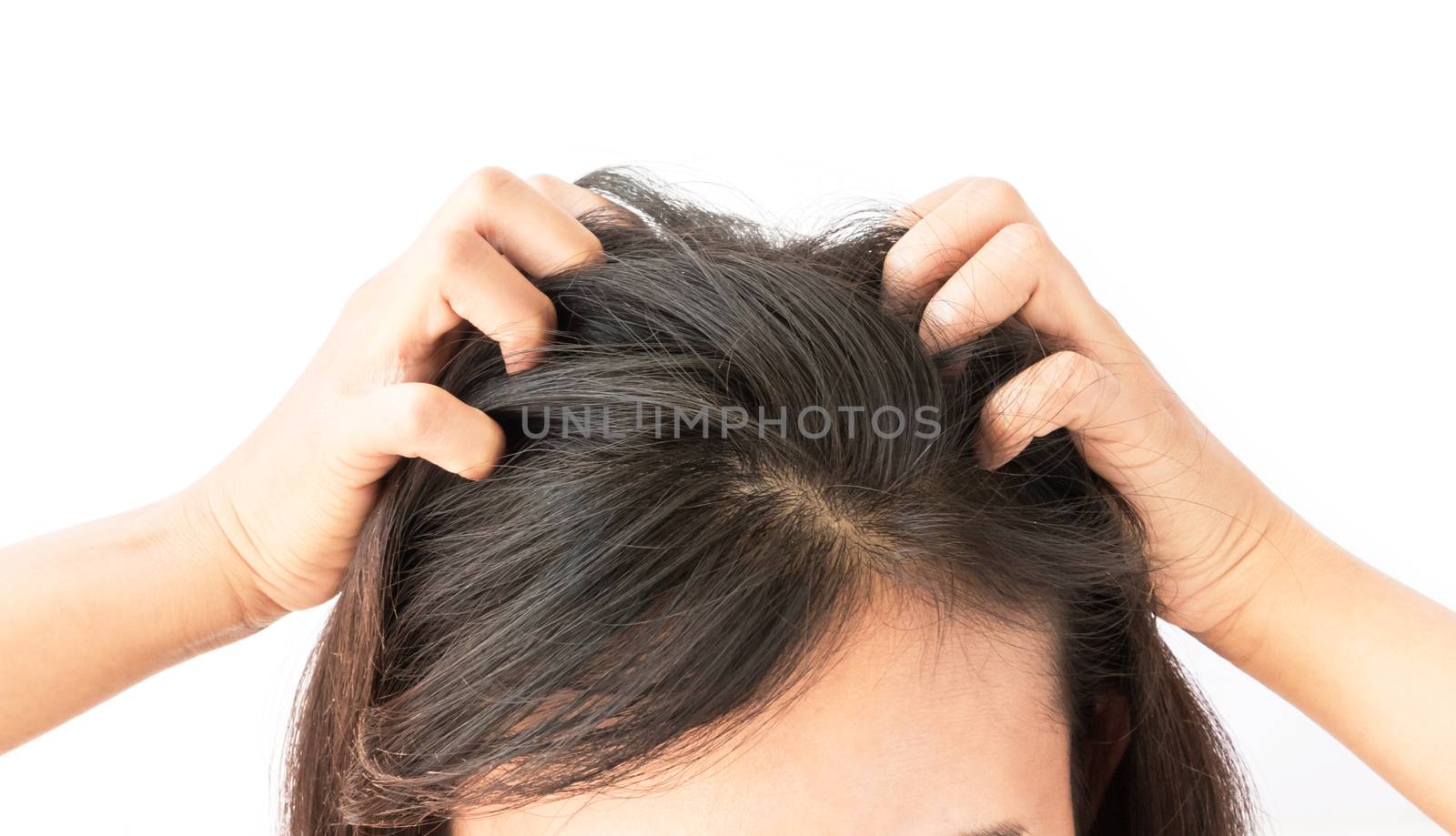 Closeup woman hand itchy scalp, Hair care concept by pt.pongsak@gmail.com