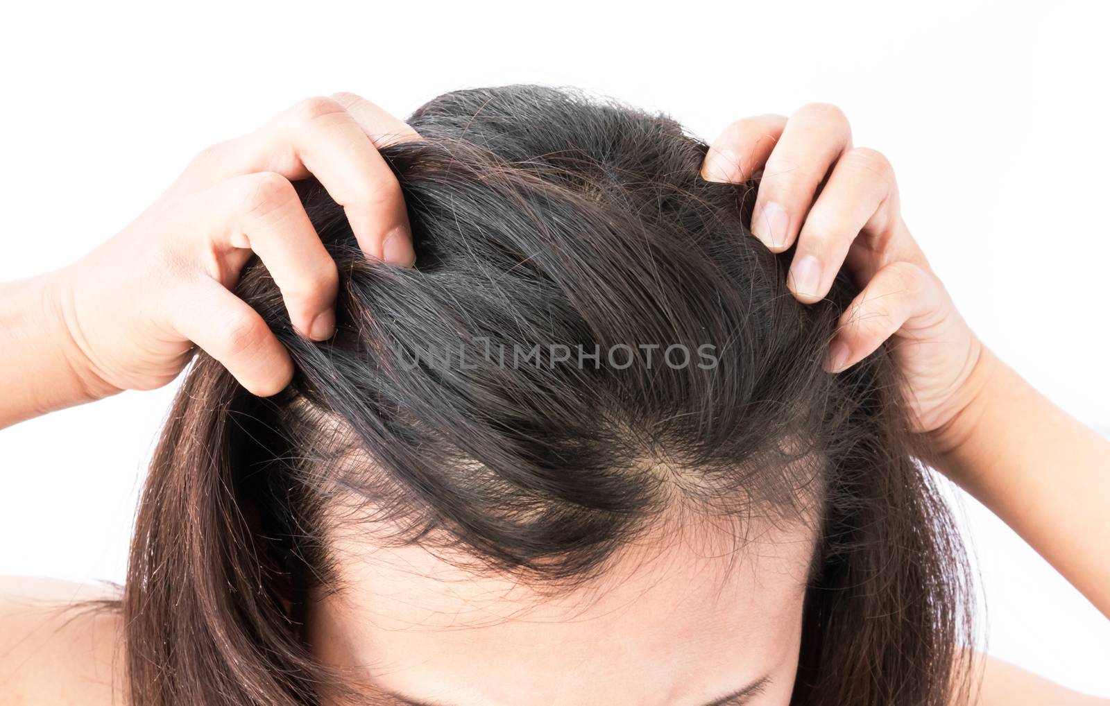 Closeup woman hand itchy scalp, Hair care concept