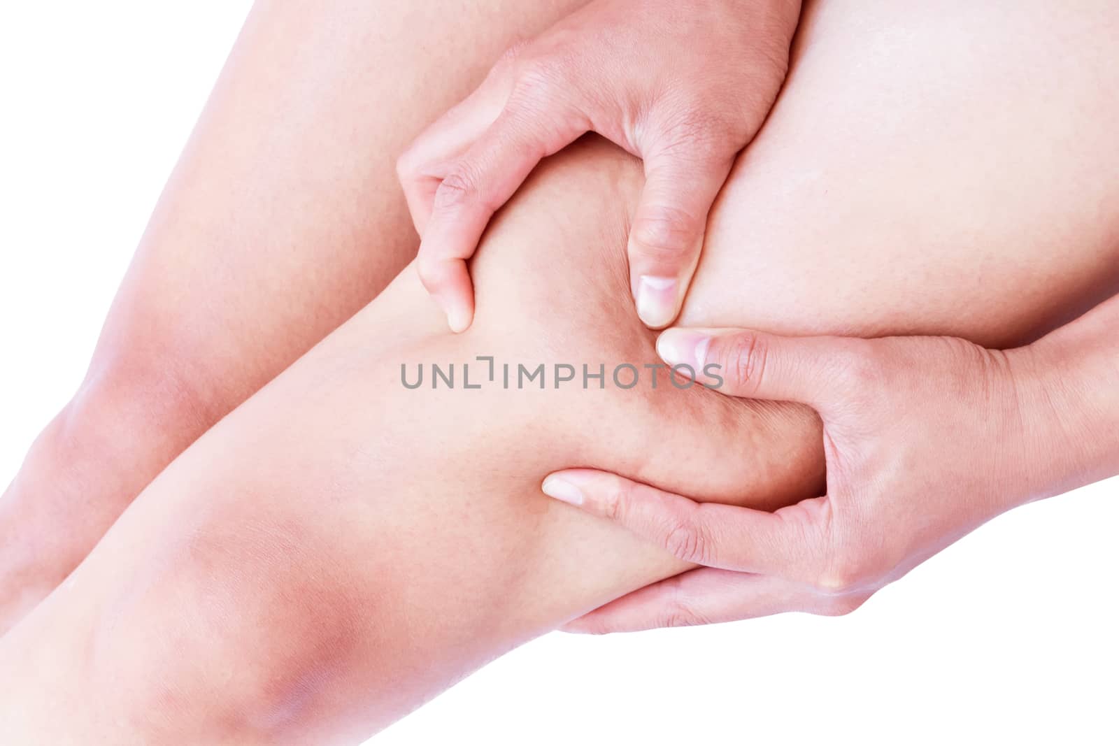 Closeup woman hand holding the skin of legs cellulite  for beauty care concept