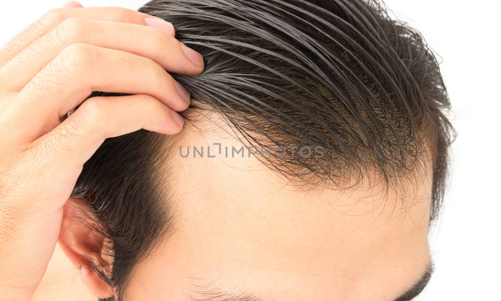 Young man worry hair loss problem for health care shampoo by pt.pongsak@gmail.com