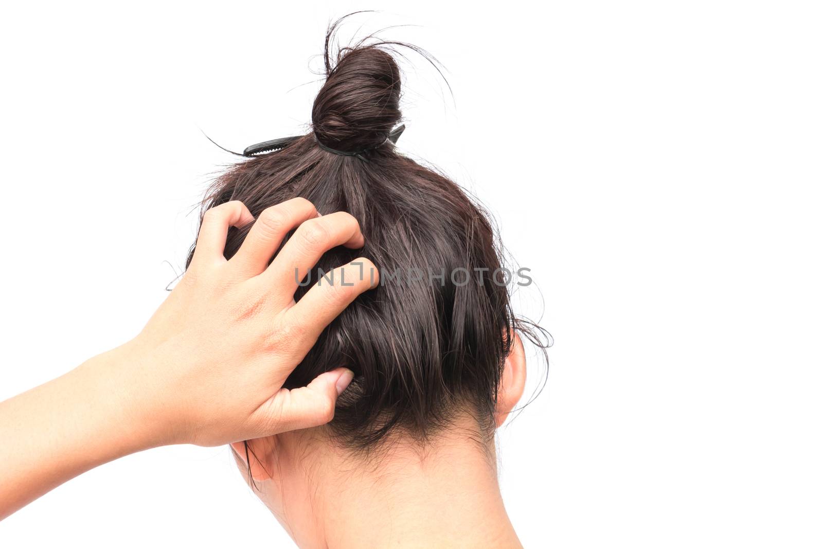 Closeup woman hand itchy scalp, Hair care concept