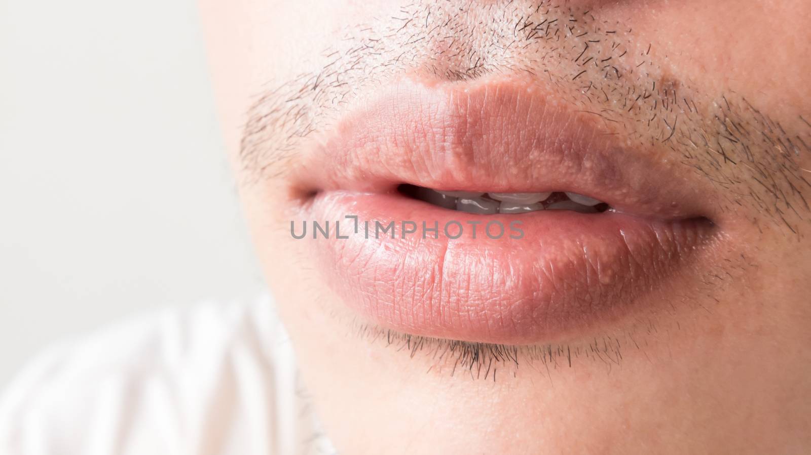 Closeup of lips man problem health care, Herpes simplex by pt.pongsak@gmail.com