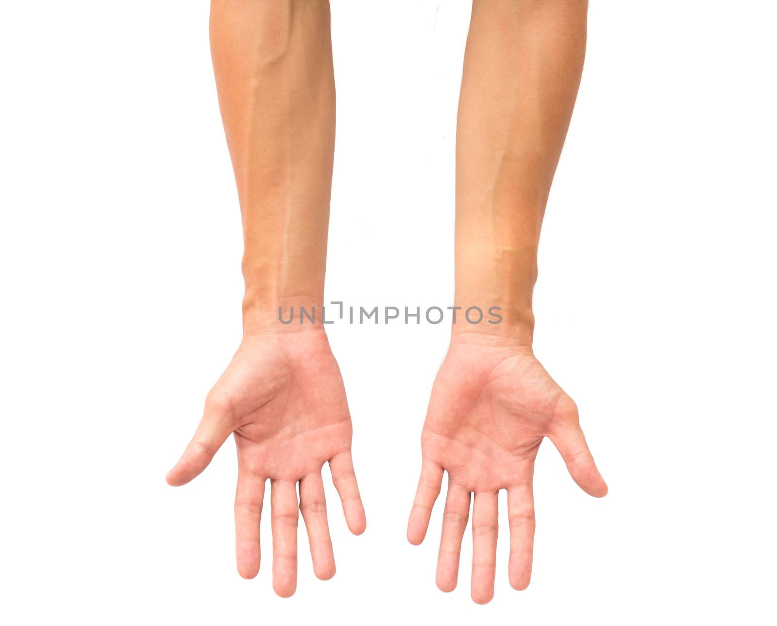 Man arm with blood veins on white background, health care and medical concept