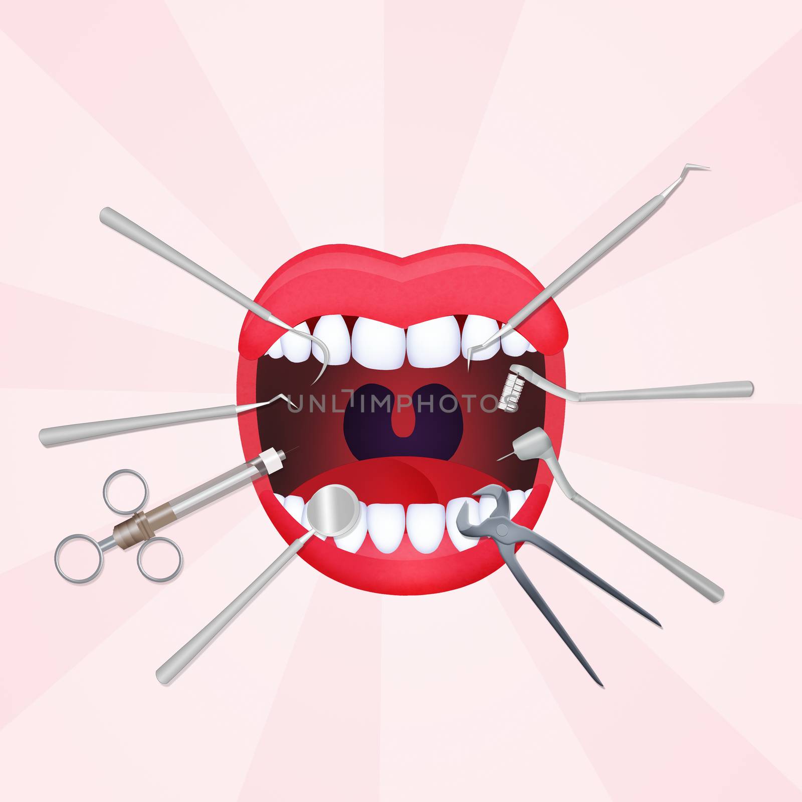 illustration of mouth open with dentist tools