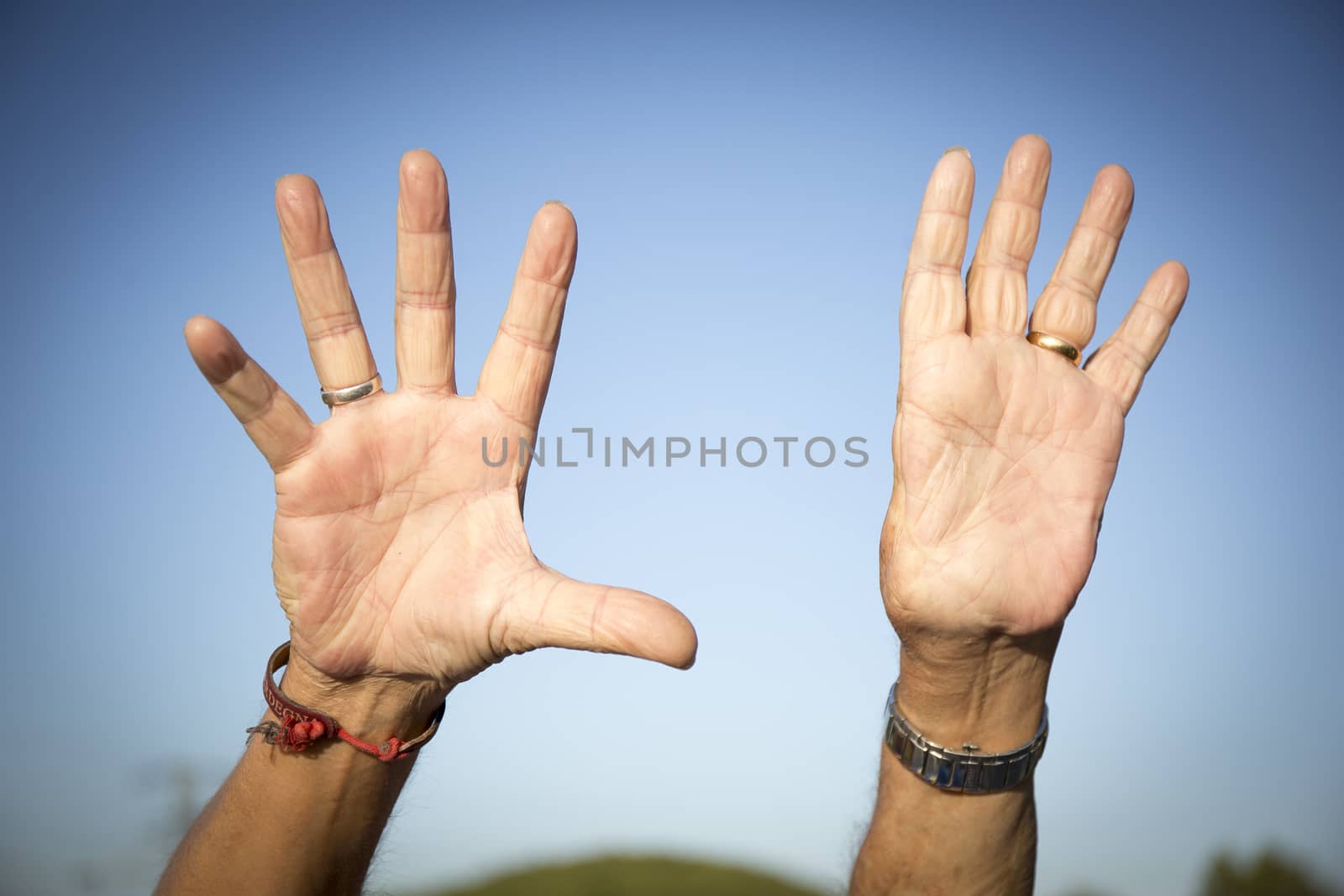 Man with only nine fingers