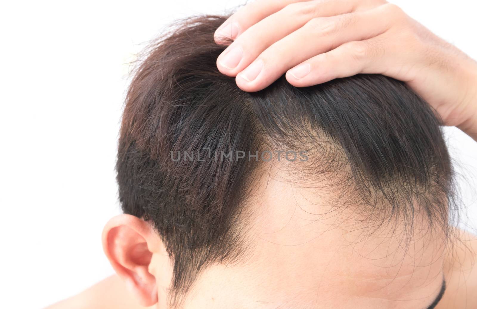 Young man worry hair loss problem for health care shampoo and be by pt.pongsak@gmail.com