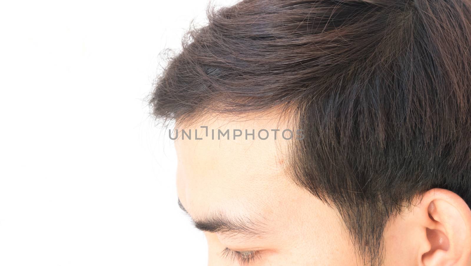 Young man worry hair loss problem for health care shampoo and beauty product concept