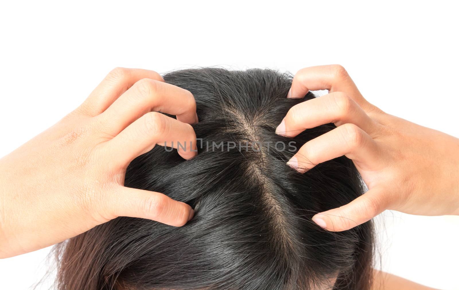 Closeup woman hand itchy scalp, Hair care concept