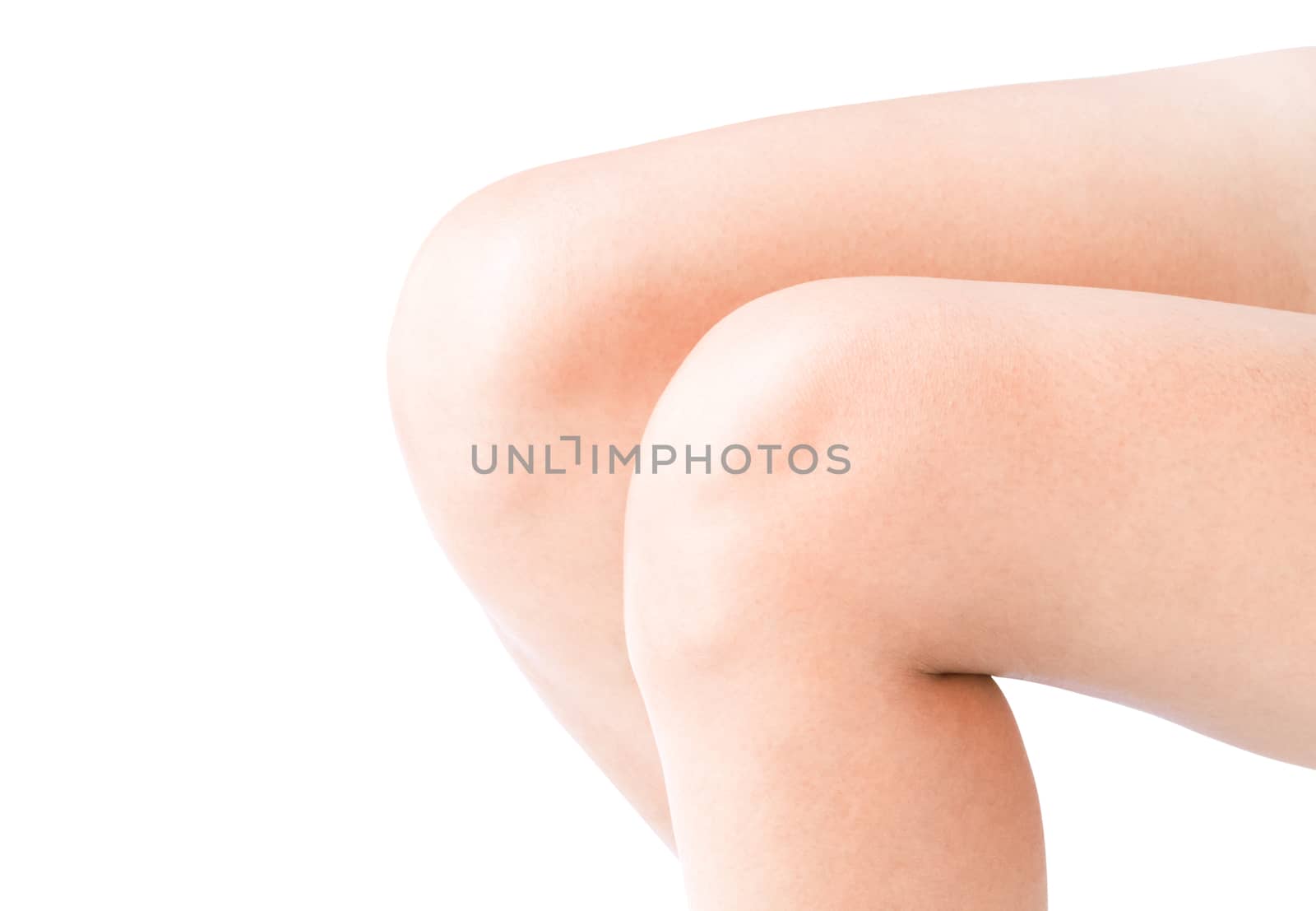 Closeup female legs with white background for health care and medicine concept