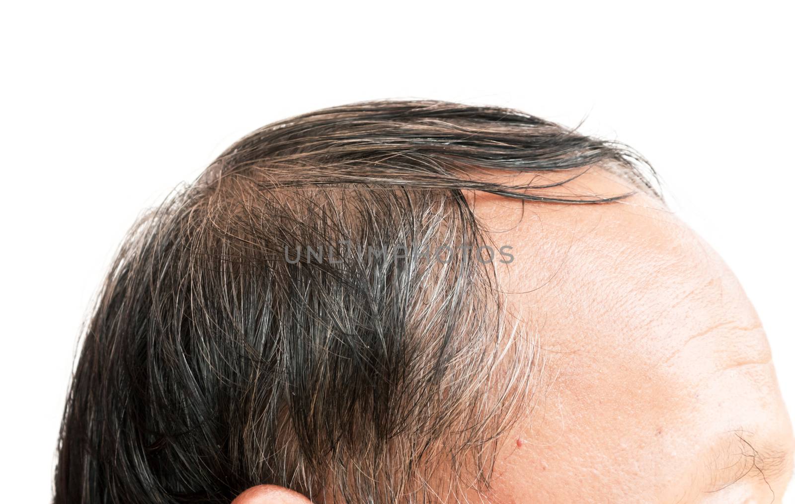 Closeup old man serious hair loss and grey hair problem with white background, hair loss concept