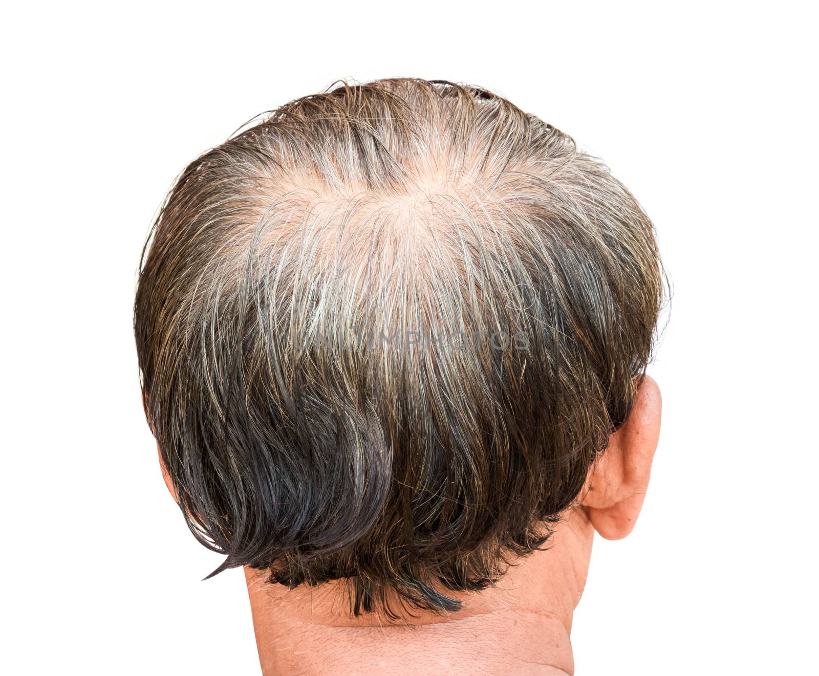 Closeup old man serious hair loss and grey hair problem with white background, hair loss concept