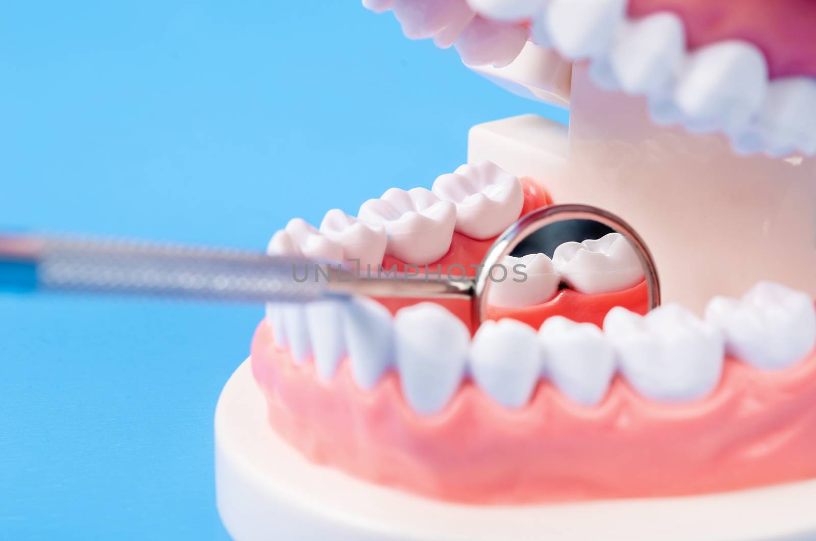 Tooth dental caries on denture with equipment dental on blue background.