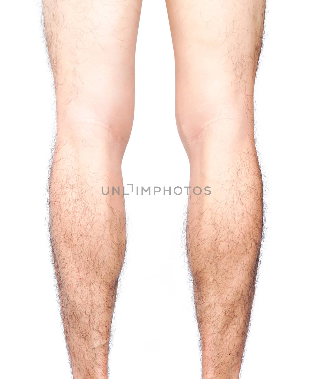 Closeup back of legs men skin and hairy with white background, health care and medical concept