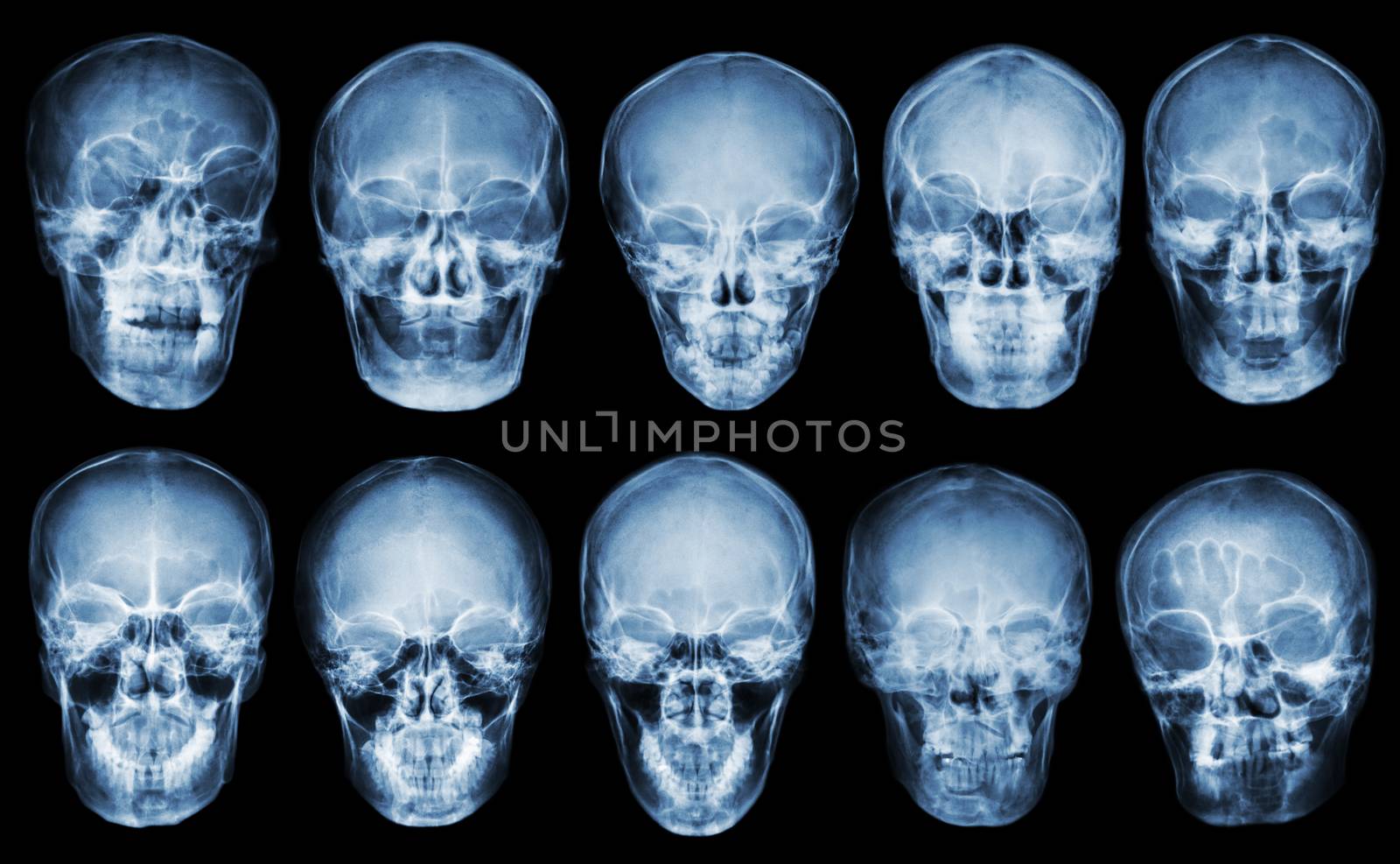 Collection of asian skull . front view . isolated background by stockdevil