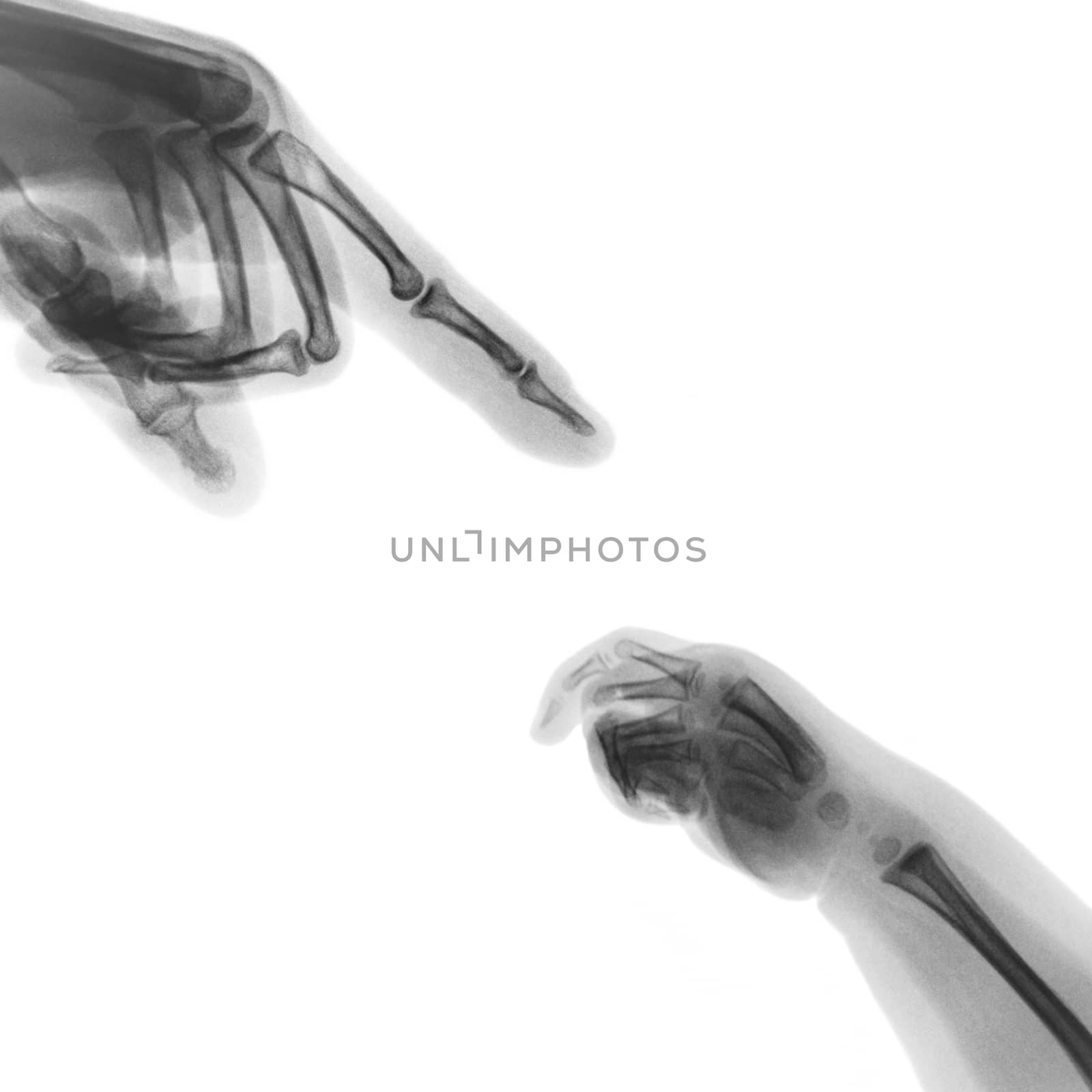 X-ray adult's hand point finger at upper side and baby's hand at lower side by stockdevil