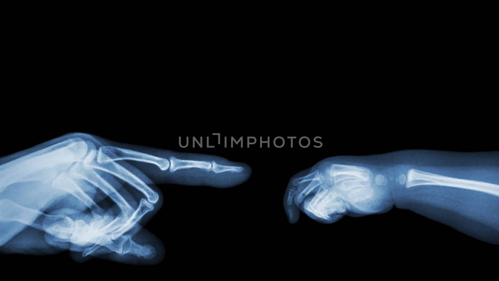 X-ray adult's hand point finger at left side and baby's hand at right side. Blank area at upper side .