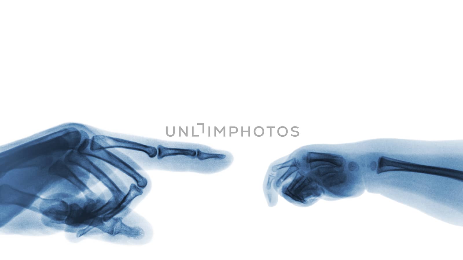 X-ray adult's hand point finger at left side and baby's hand at right side. Blank area at upper side by stockdevil