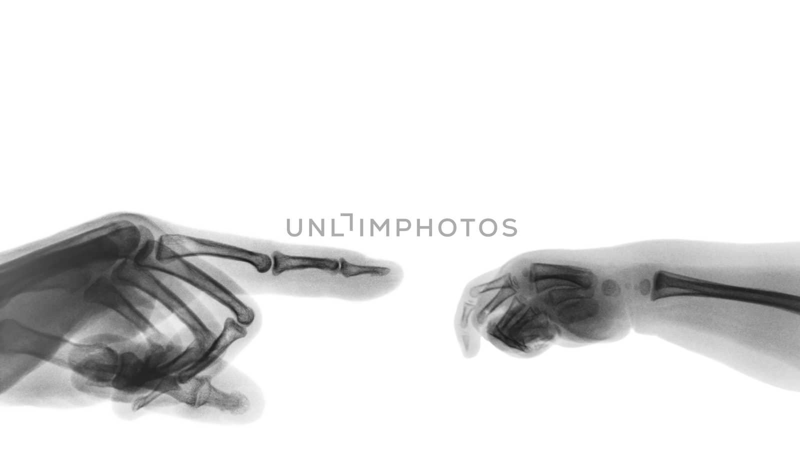 X-ray adult's hand point finger at left side and baby's hand at right side. Blank area at upper side .