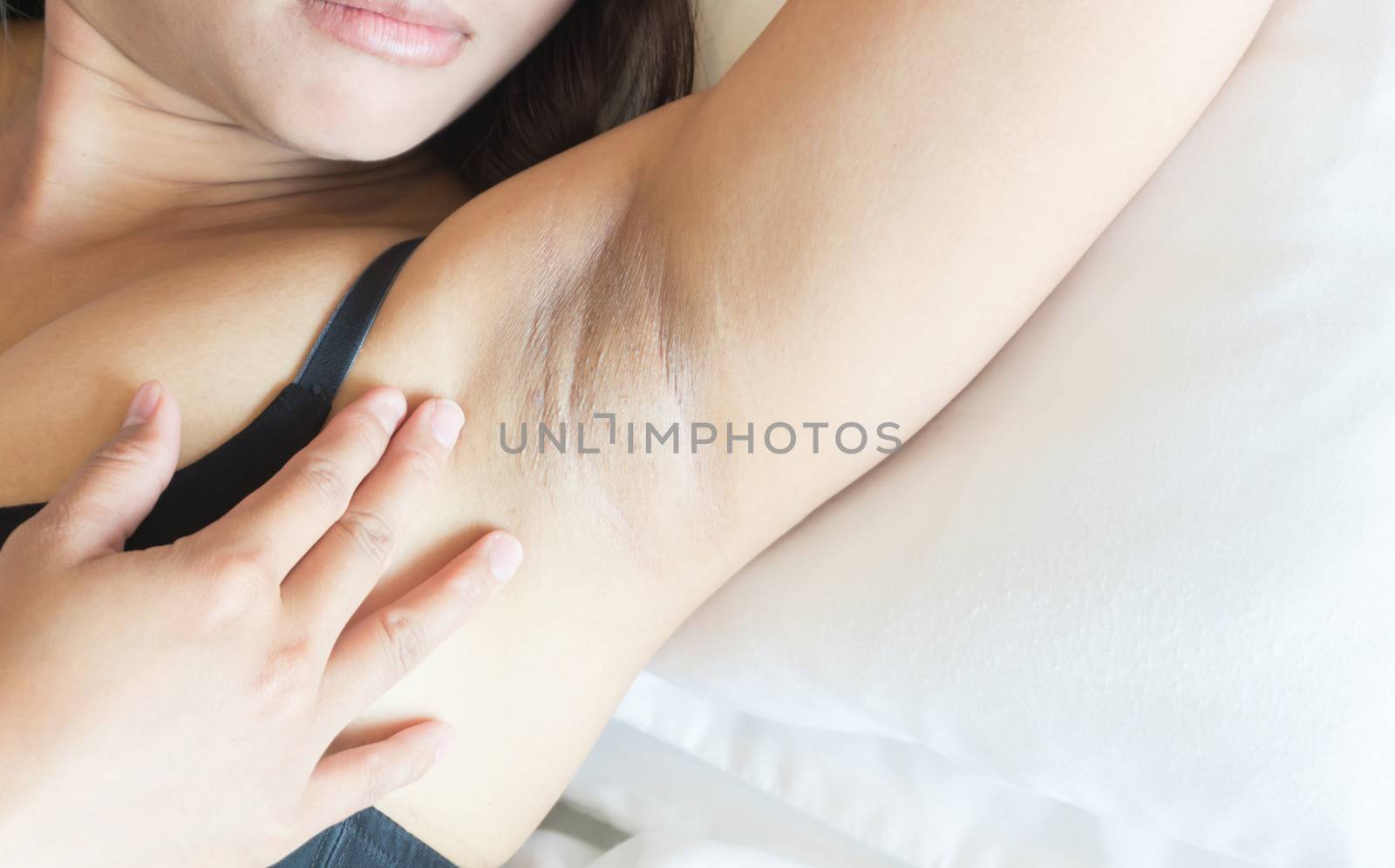 Women problem black armpit for skin care and beauty concept
