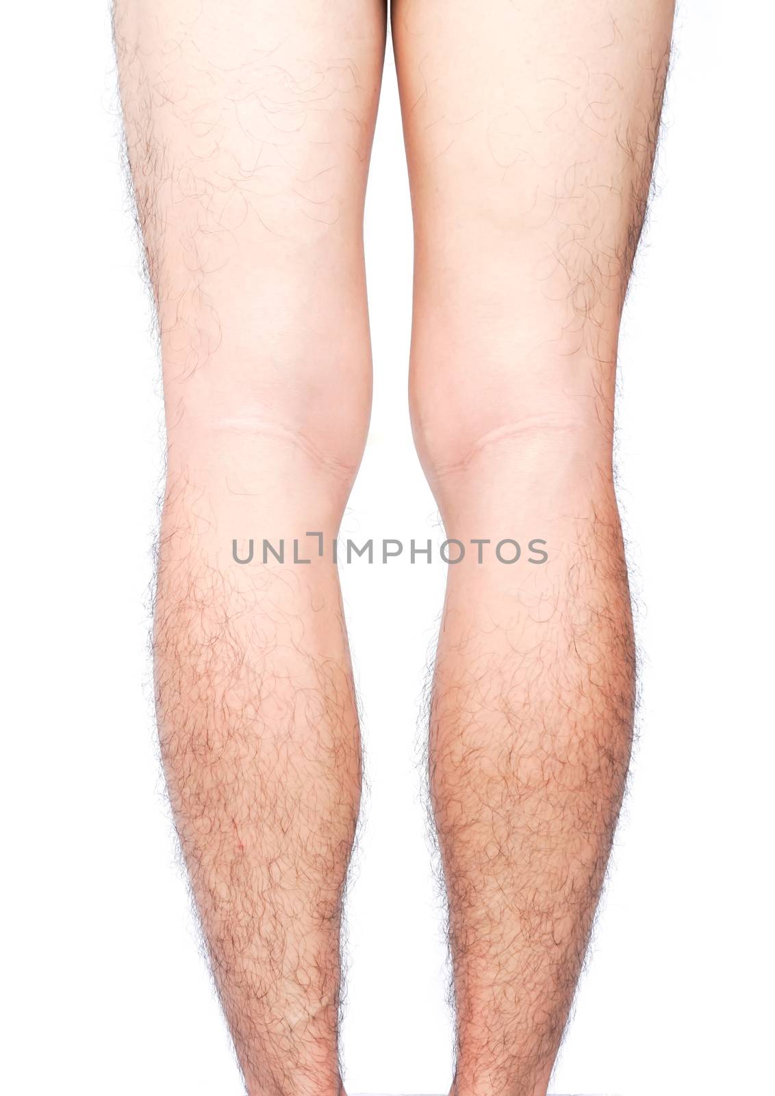 Closeup back of legs men skin and hairy with white background, health care and medical concept