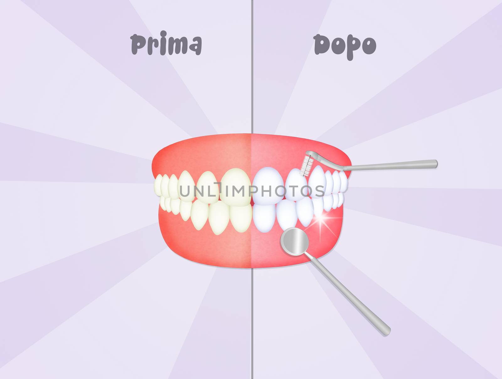 before and after cleaning the teeth by adrenalina