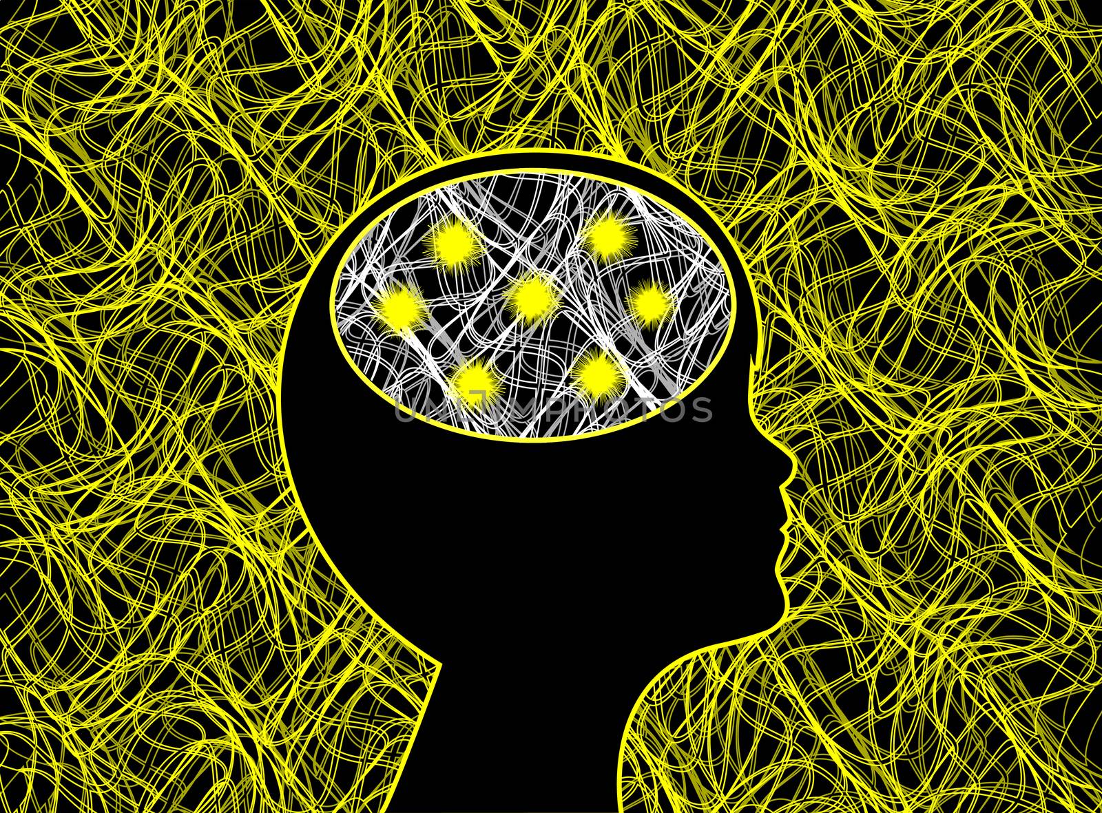 Electrosmog can trigger epileptic seizures