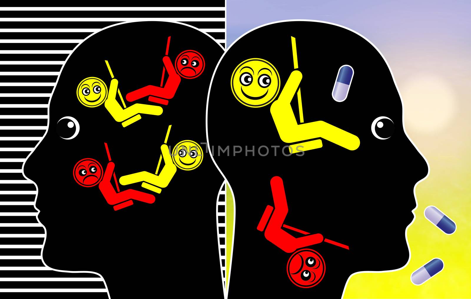 Treatment of Bipolar Disorder by Bambara