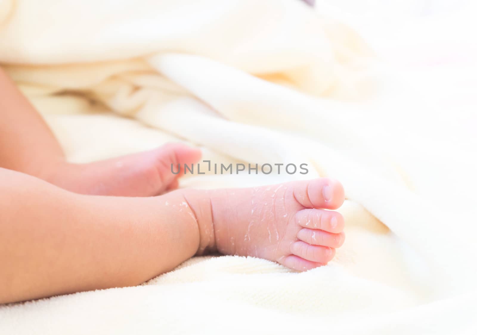 Closeup legs of newborn with peeling skin on white cloth, health care and medical concept, selective focus
