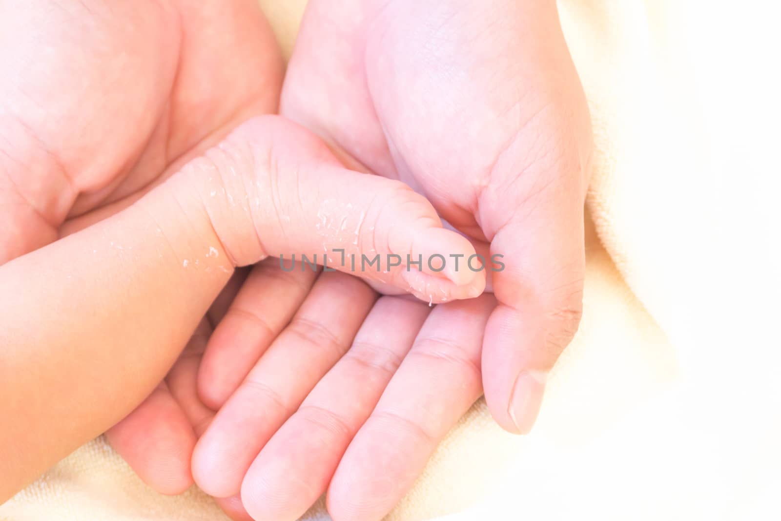 Closeup legs of newborn with peeling skin on mother hands, health care and medical concept