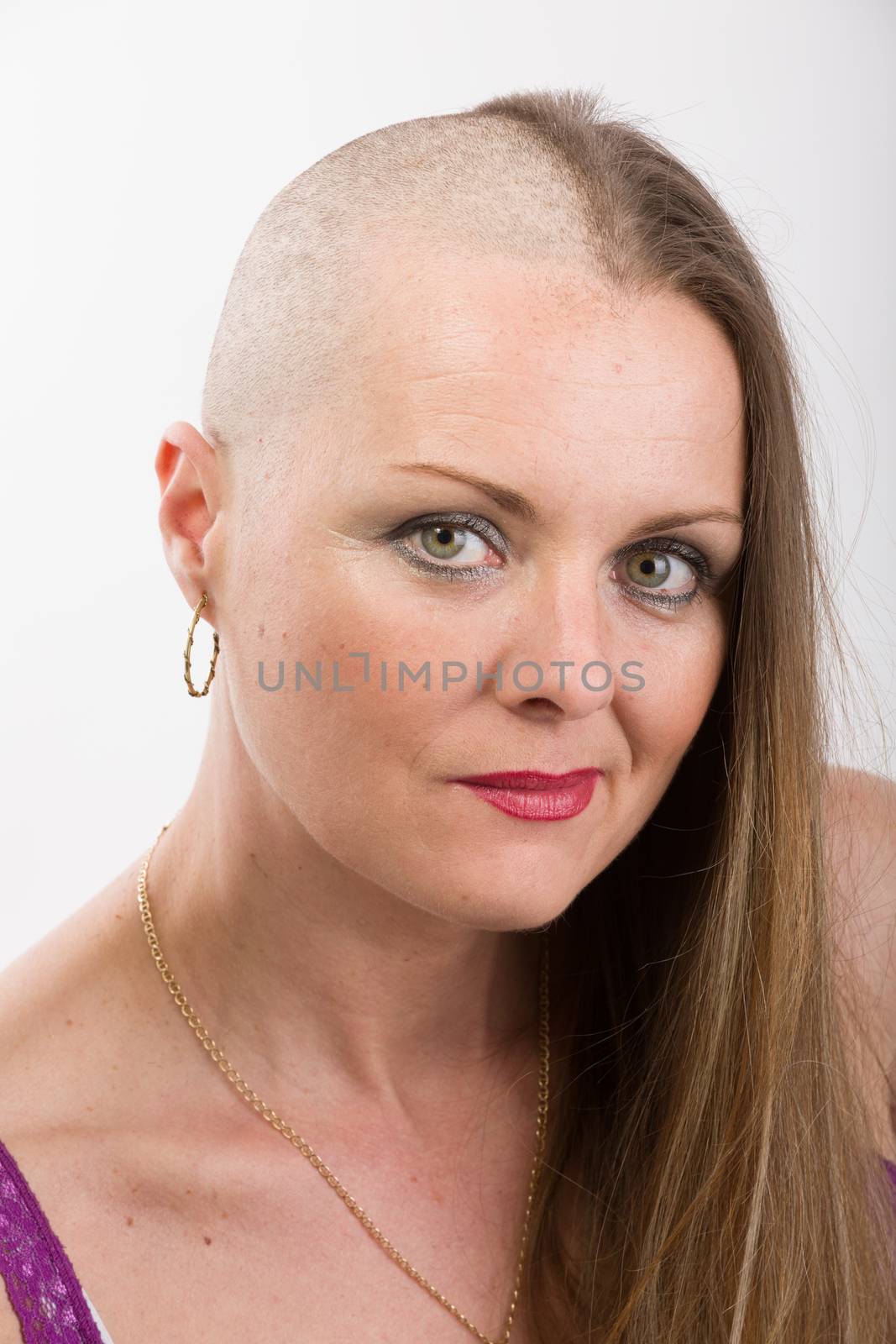 Portrait of smiling beautiful middle age woman patient with cancer with partially shaved head, hope in healing. She lost her hair
