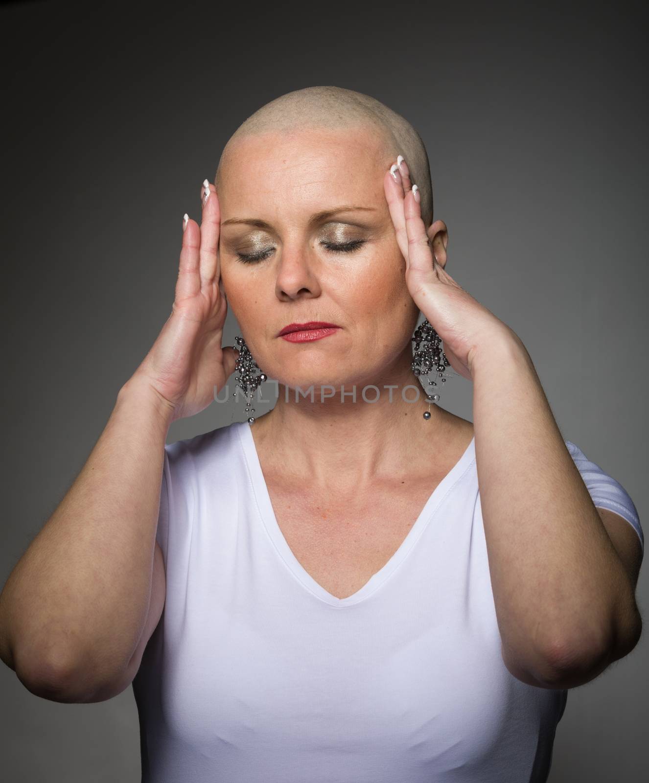 beautiful woman cancer patient without hair by artush