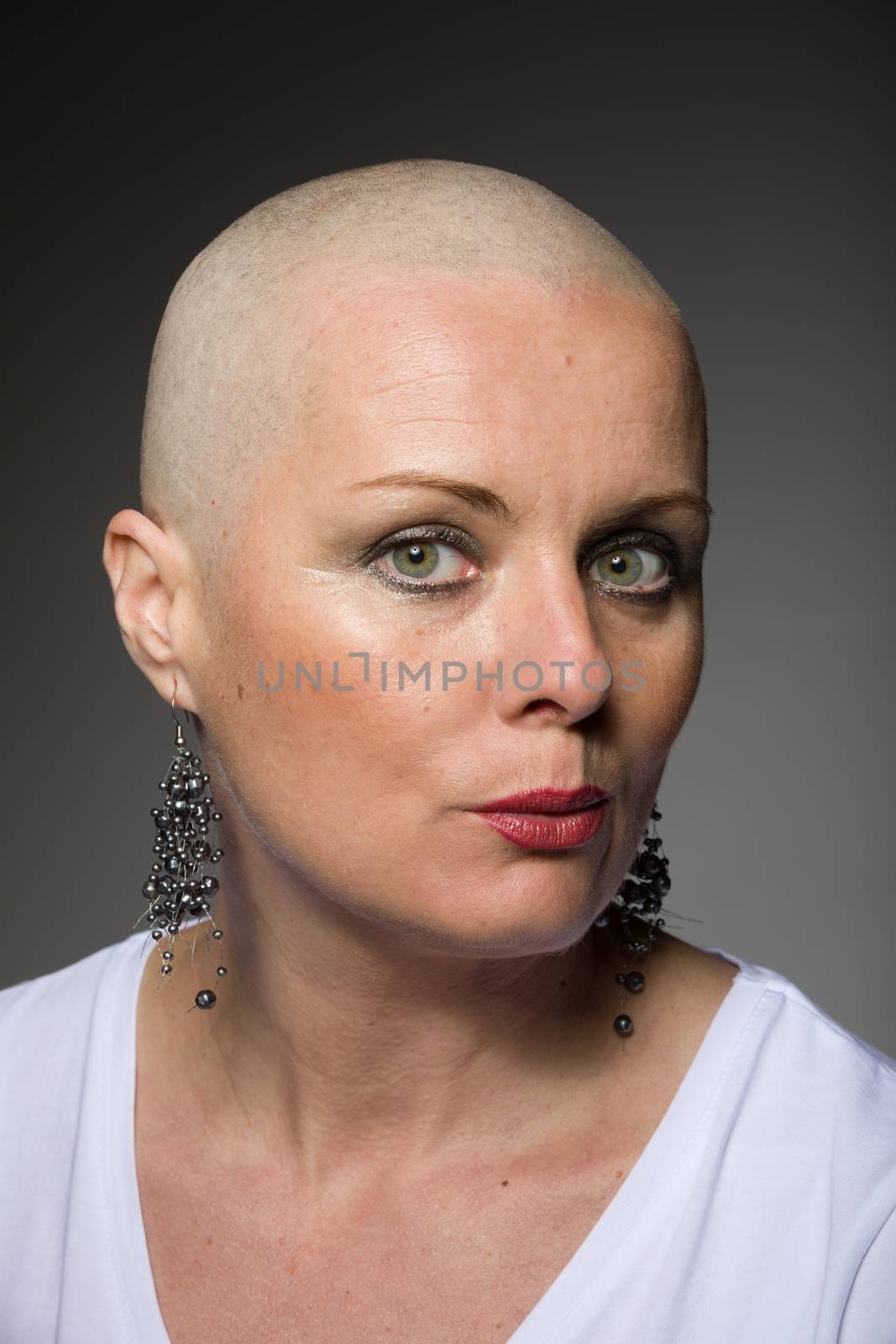Portrait of beautiful middle age woman sad patient with cancer with shaved head without hair, hope in healing.