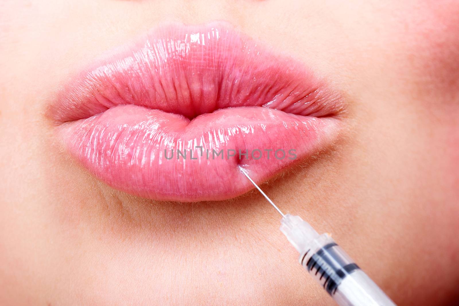 Closeup shot of beautiful young woman receiving filler injection in lips, beauty treatment concept