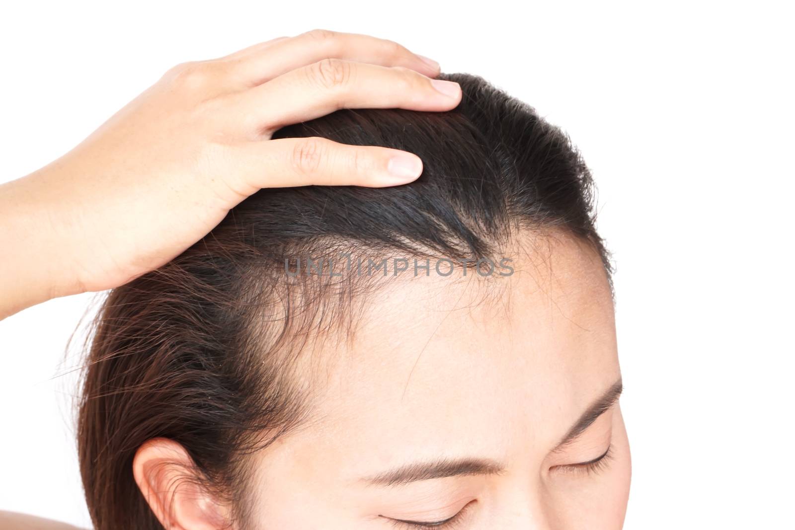 Woman serious hair loss problem for health care shampoo and beauty product concept