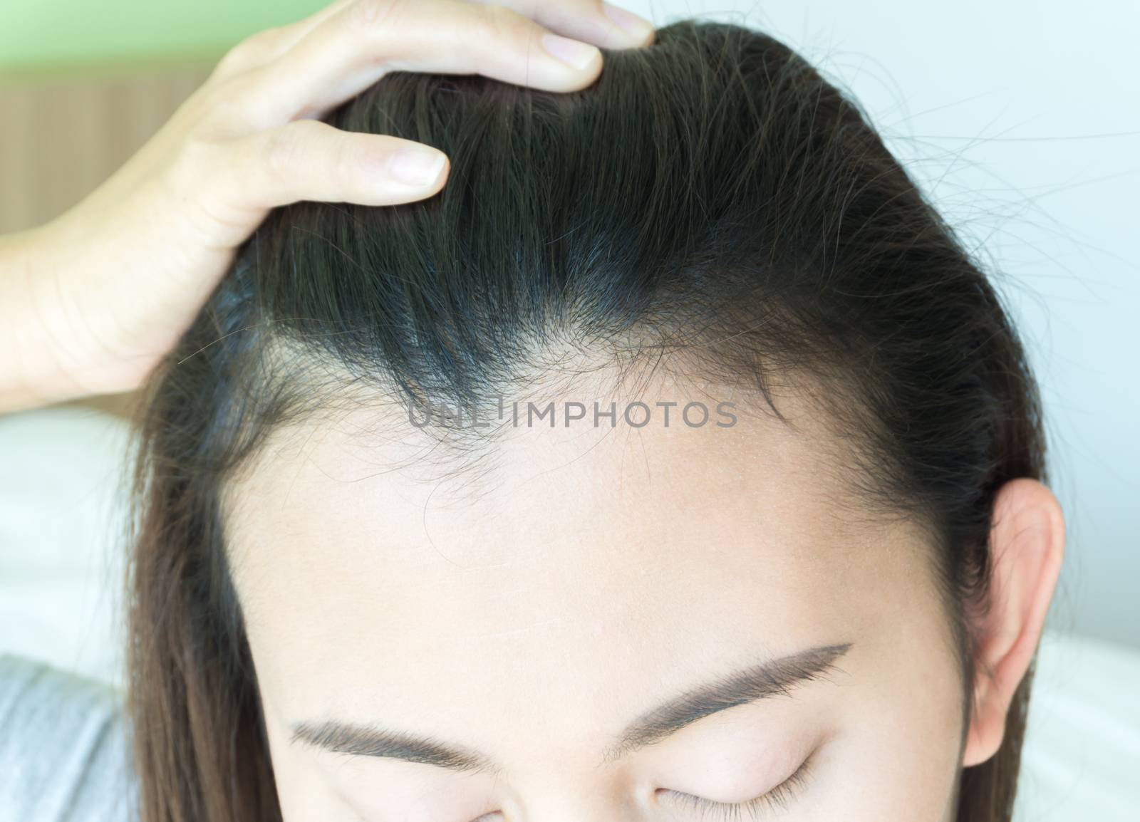 Woman serious hair loss problem for health care shampoo and beauty product concept