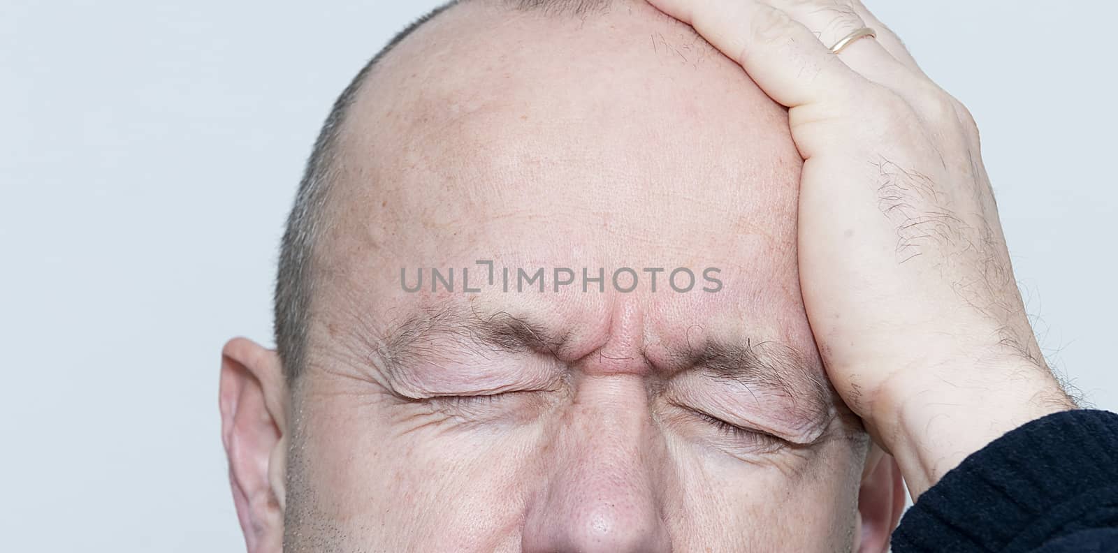 a man with a headache