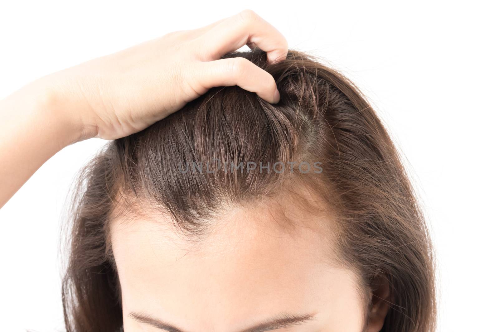 Woman serious hair loss problem for health care shampoo and beauty product concept