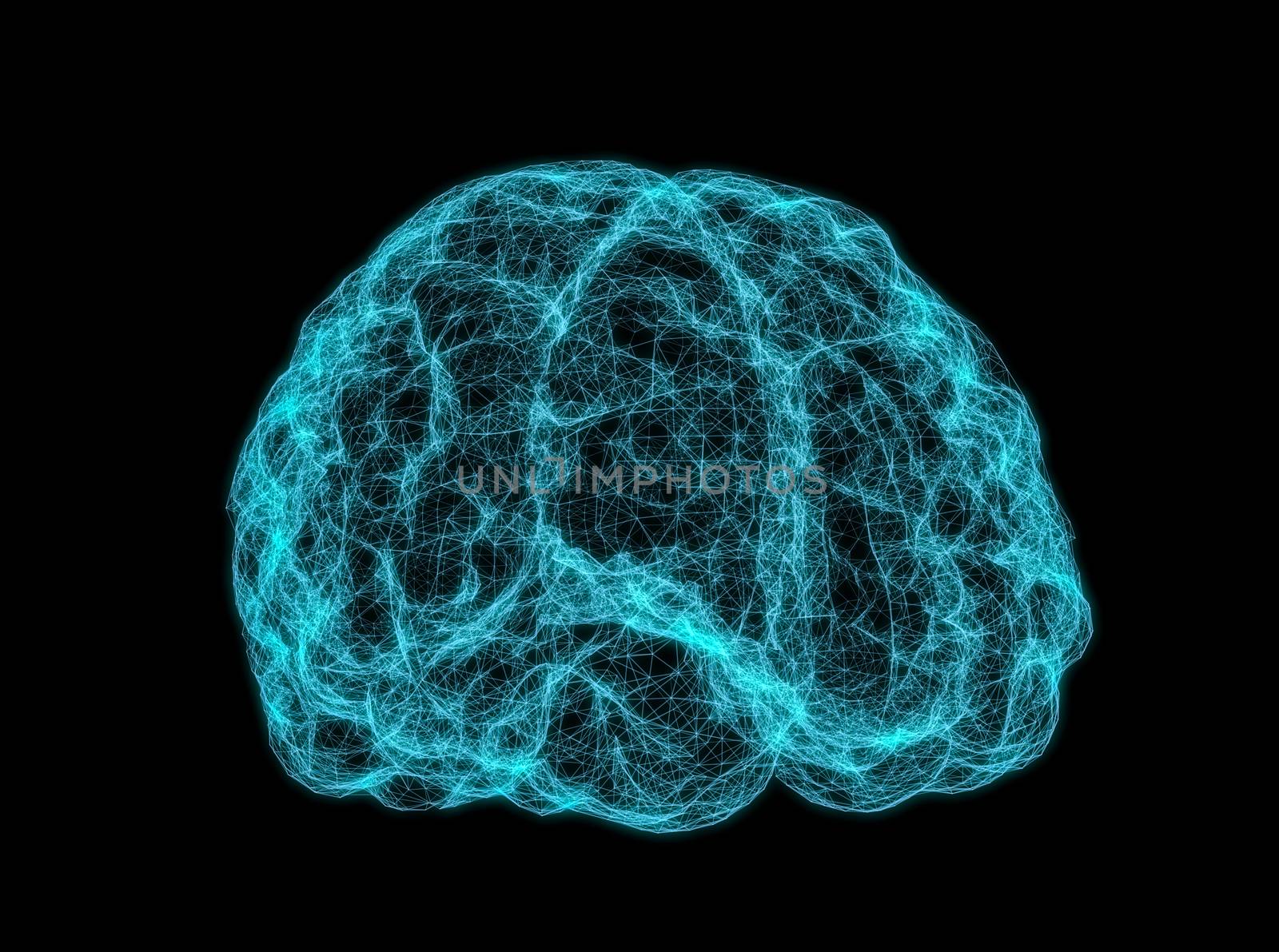 X-ray image of human brain by cherezoff