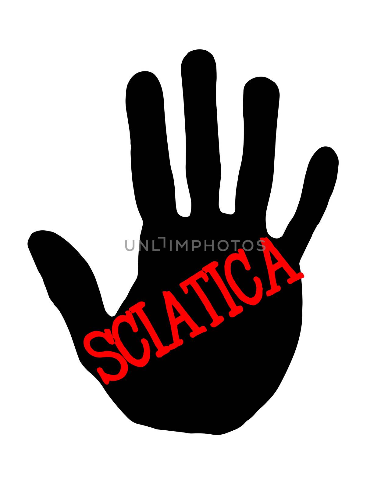 Handprint sciatica by Milovan