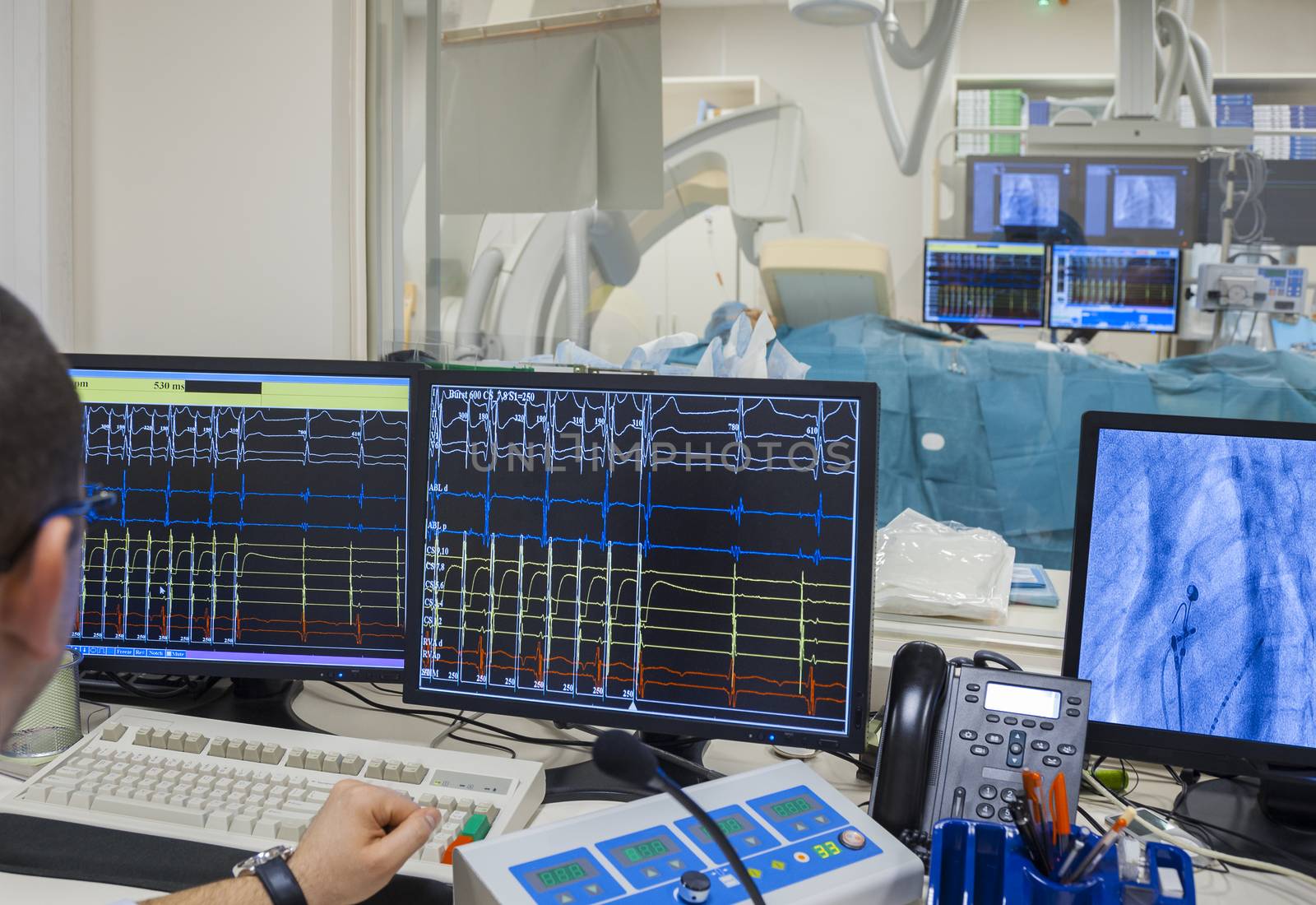 Monitors with heartbeat rate and x-ray image in modern hospital operating room.