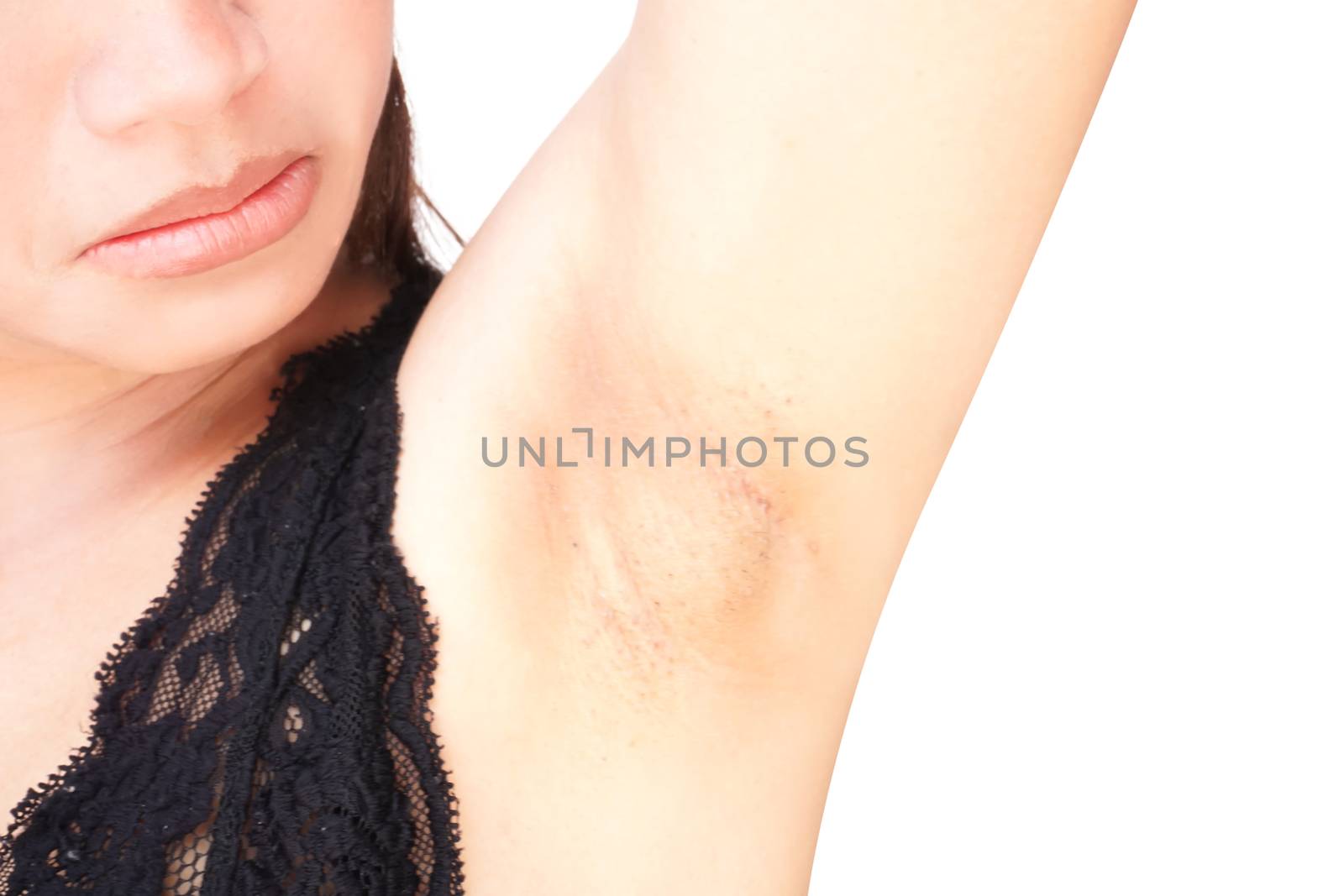 Women problem black armpit on white background for skin care and by pt.pongsak@gmail.com